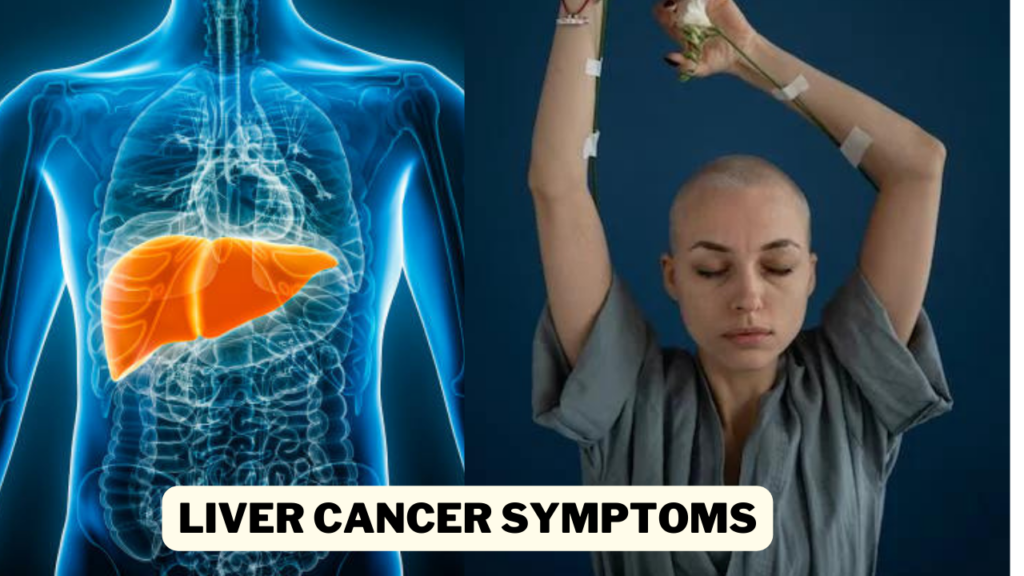 Liver Cancer Symptoms