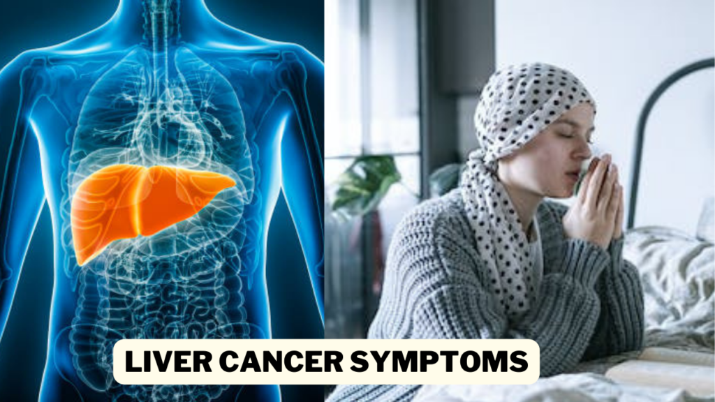 Liver Cancer Symptoms